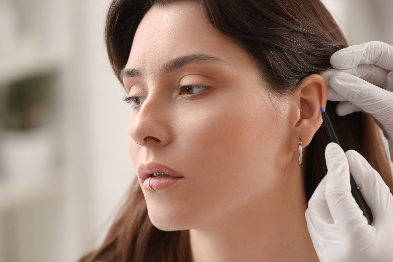 Otoplastia em Goiânia