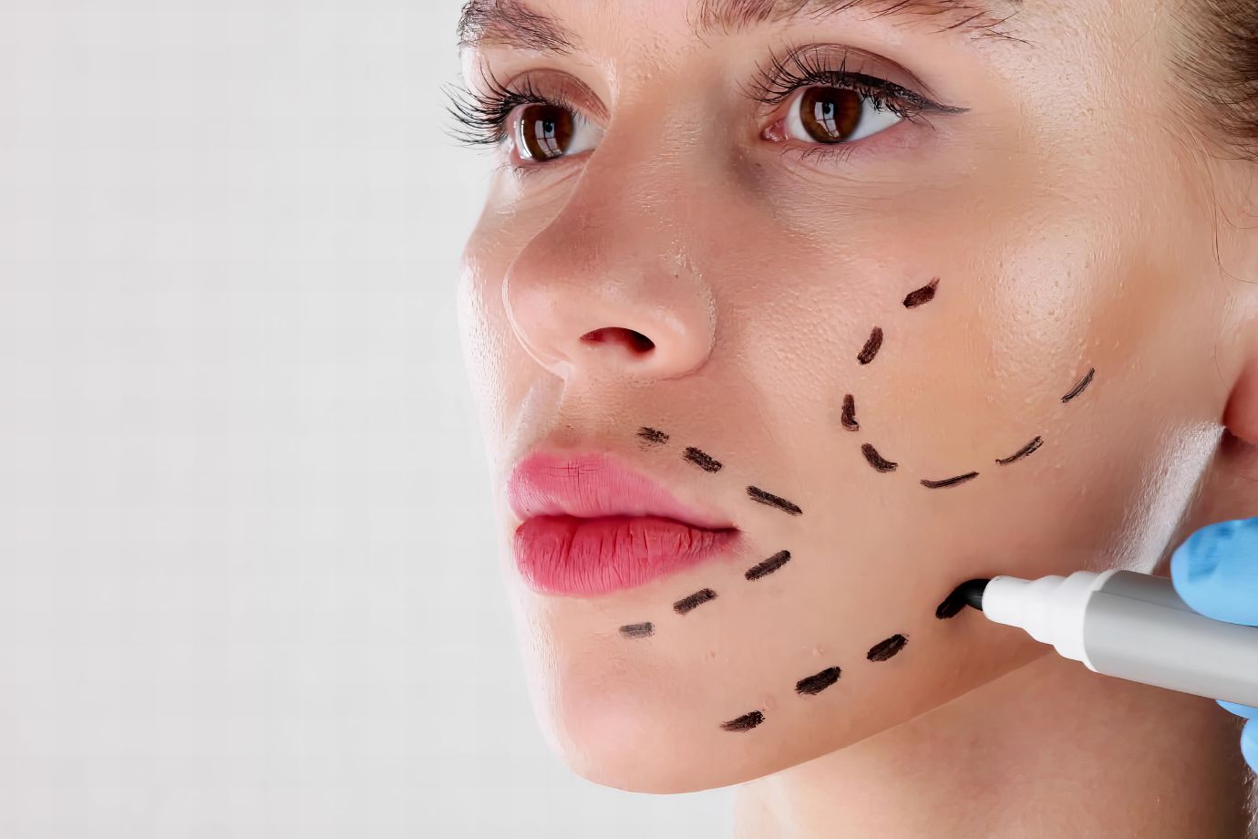 Implantes faciais em Goiânia