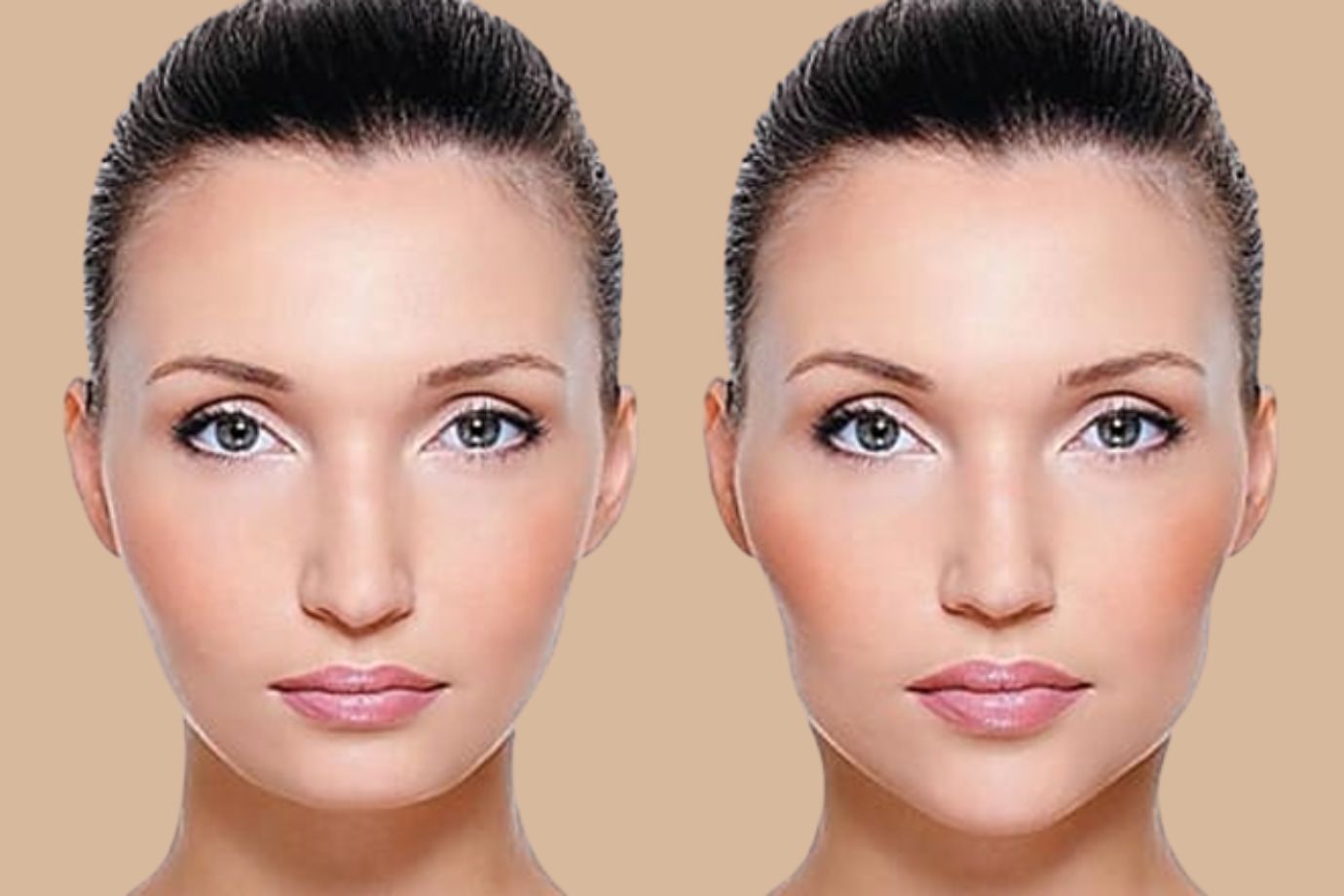 Implante de mandíbula em Goiânia