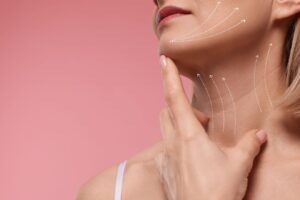 Lifting facial em Goiânia